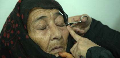Yemen Cataract Surgery