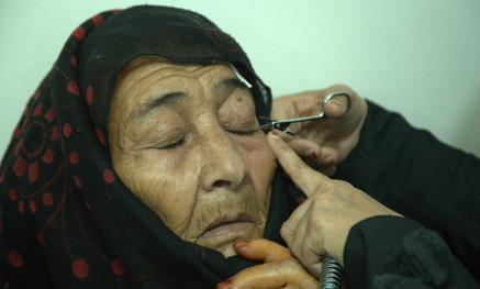 Woman receiving cataract surgery