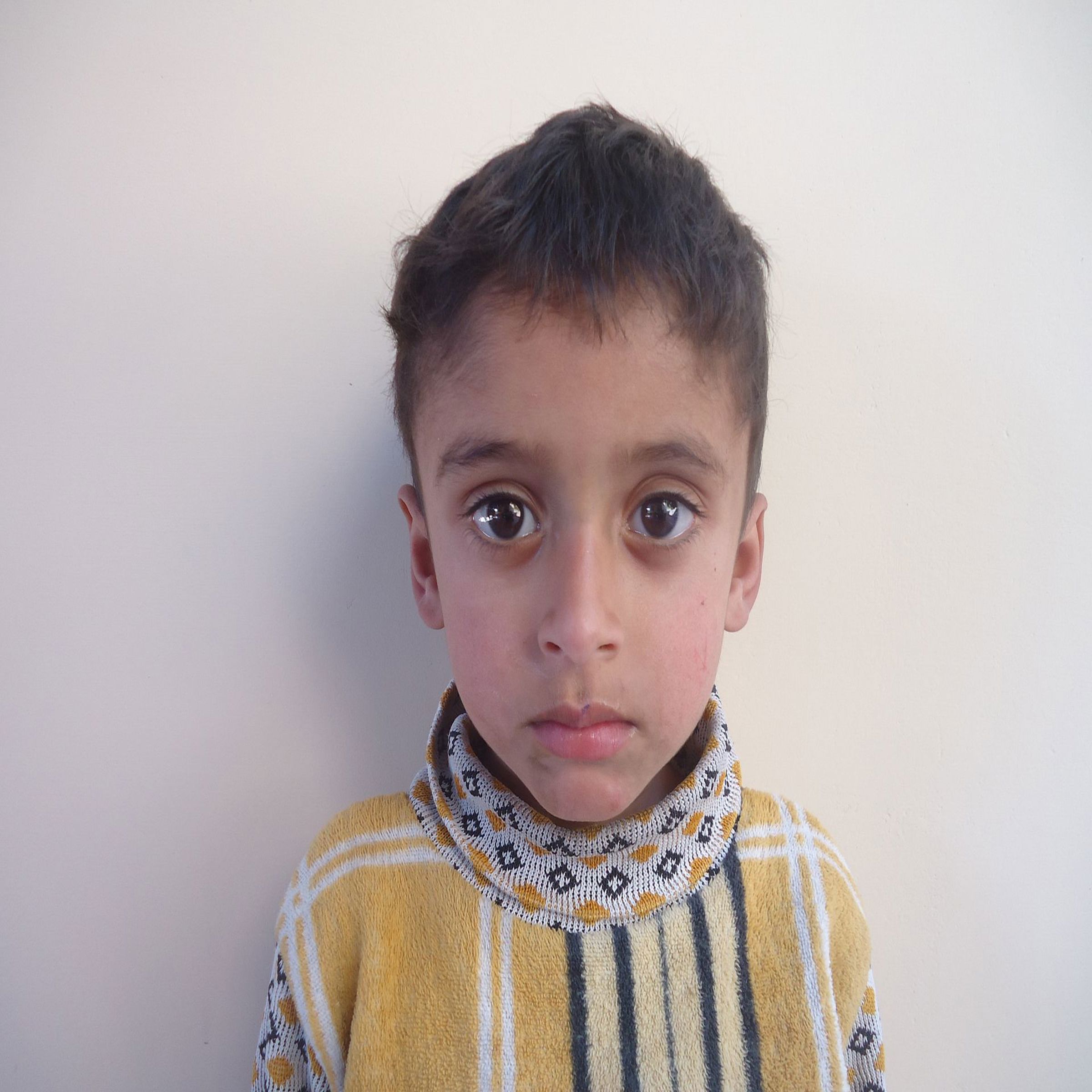 Human Appeal Orphan - Abrak Ali